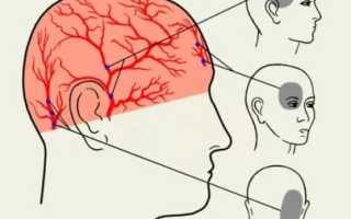 Часто болит голова в области шеи и затылка