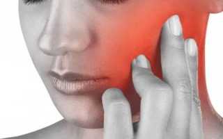 Болит голова в правой части и отдает в челюсть