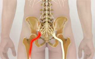Почему у меня сильно болит внизу спины