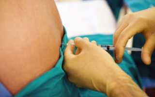 Болит спина и шея после спинальной анестезии