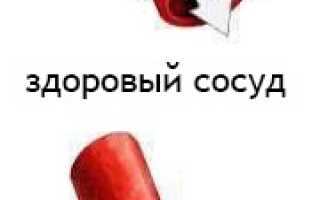 Болит голова чем расширить сосуды головного мозга