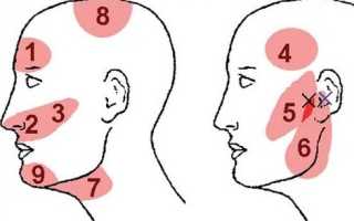 Что делать если постоянно болит голова и виски