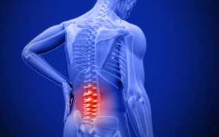 Если болит спина внизу и правая нога