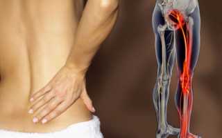 Болит спина и немеет мышца на ноге