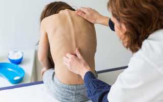Болит спина у подростка к какому врачу