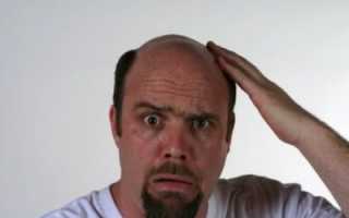 Болит кожа головы выпадают волосы чешется голова