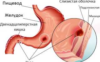 Болит спина живот справа
