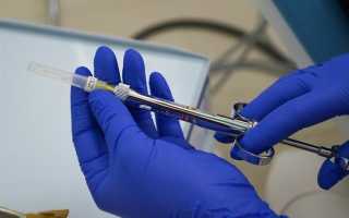 Вырвал зуб болит голова