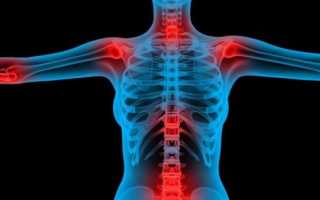 Когда лежу у меня болит спина между лопатками