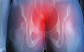 Болит спина в области копчика к какому врачу идти