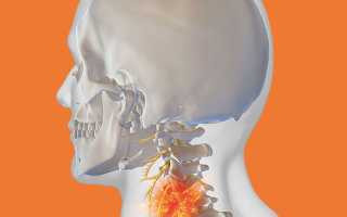 Болит голова спина шея