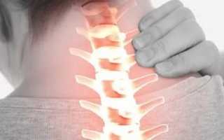 Болит мышца на шее справа отдает в голову