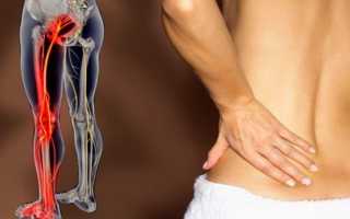 От чего болит спина и боль отдает в ногу
