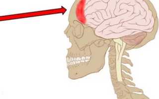 Если болит голова лобная часть головы