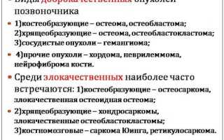 Болит спина выше поясницы ближе к позвоночнику
