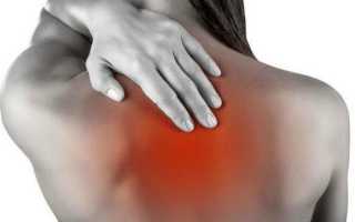 Болит спина между лопаток что делать