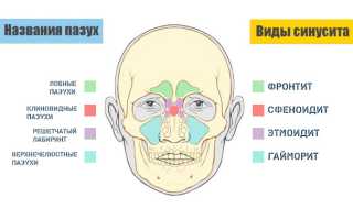 Болит горло отдает в уши и очень болит голова что это может быть