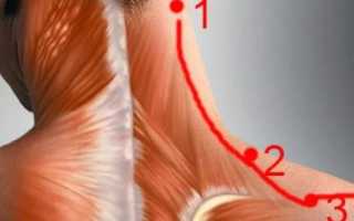 К какому врачу обратиться если болит шея и голова