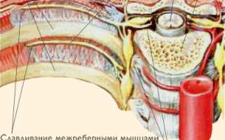 Что может болеть в межреберье в спине