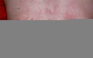 Долго болит спина после ушиба