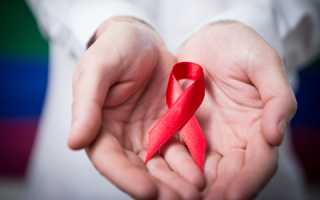 Когда болит голова при вич