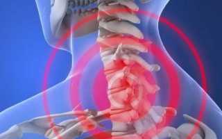 Болит шея и голова снизу