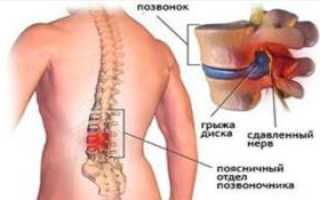 Болят суставы спина поясница ноги шея