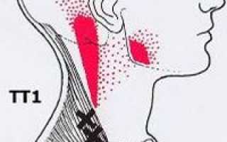 Почему болят точки на спине