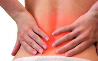 Болит спина в области поясницы чем лечить видео