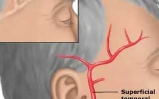 Почему часто болит правый висок головы