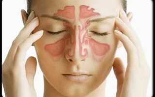 Что делать если болит переносица и голова что это