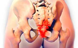 Когда сижу или лежу на спине болит копчик