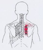 почему болят точки на спине