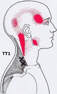 почему болят точки на спине