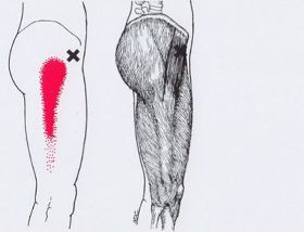 почему болят точки на спине