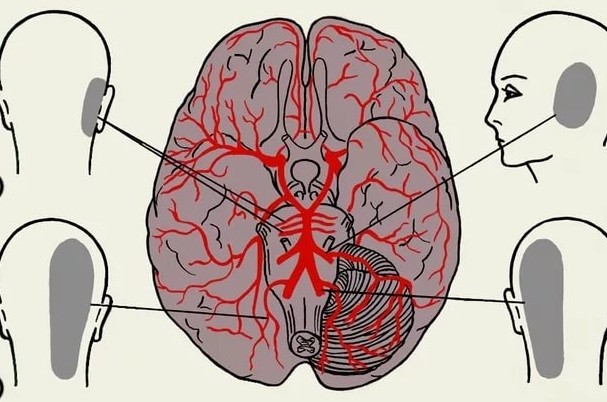 Если болит голова в области затылка с левой стороны