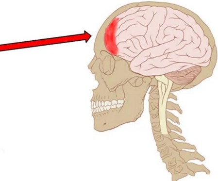 Если болит голова лобная часть головы