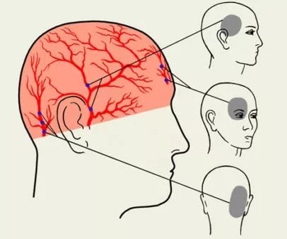 Часто болит голова в области шеи и затылка