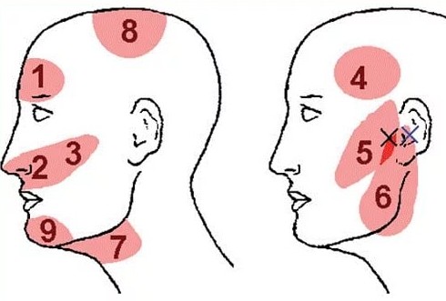 Что делать если постоянно болит голова и виски