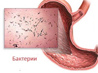 Болит голова спина живот тошнит