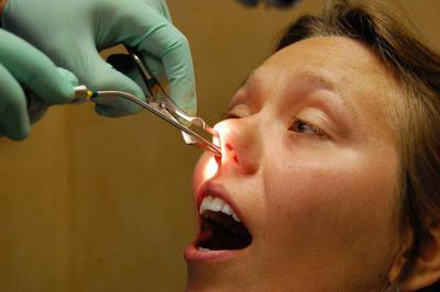 почему болит кость под глазом