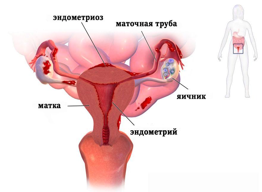 Мажущие выделения в середине цикла