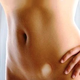 паховая грыжа