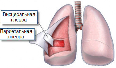 Почему болят рёбра спереди и сзади5