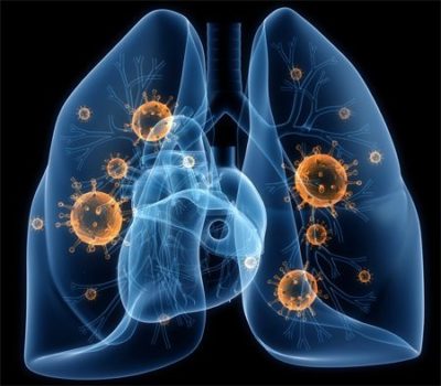 рвота болит правый бок и спина