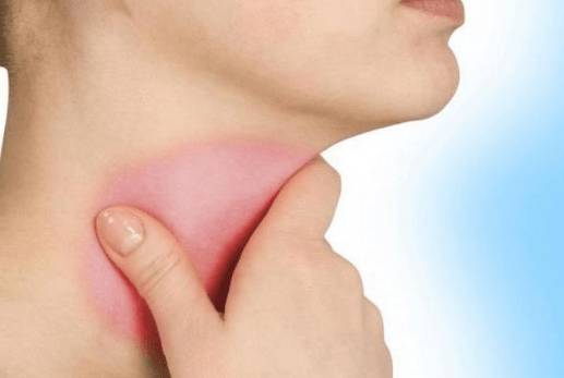 болит голова и горло температуры нет что это