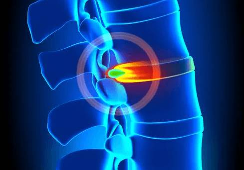 Почему болит спина в области лопаток и шеи