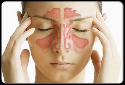 Синусит - причина головных болей в переносице
