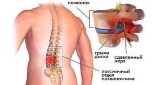 Болят суставы спина поясница ноги шея