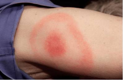 болит голова и слабость во всем теле